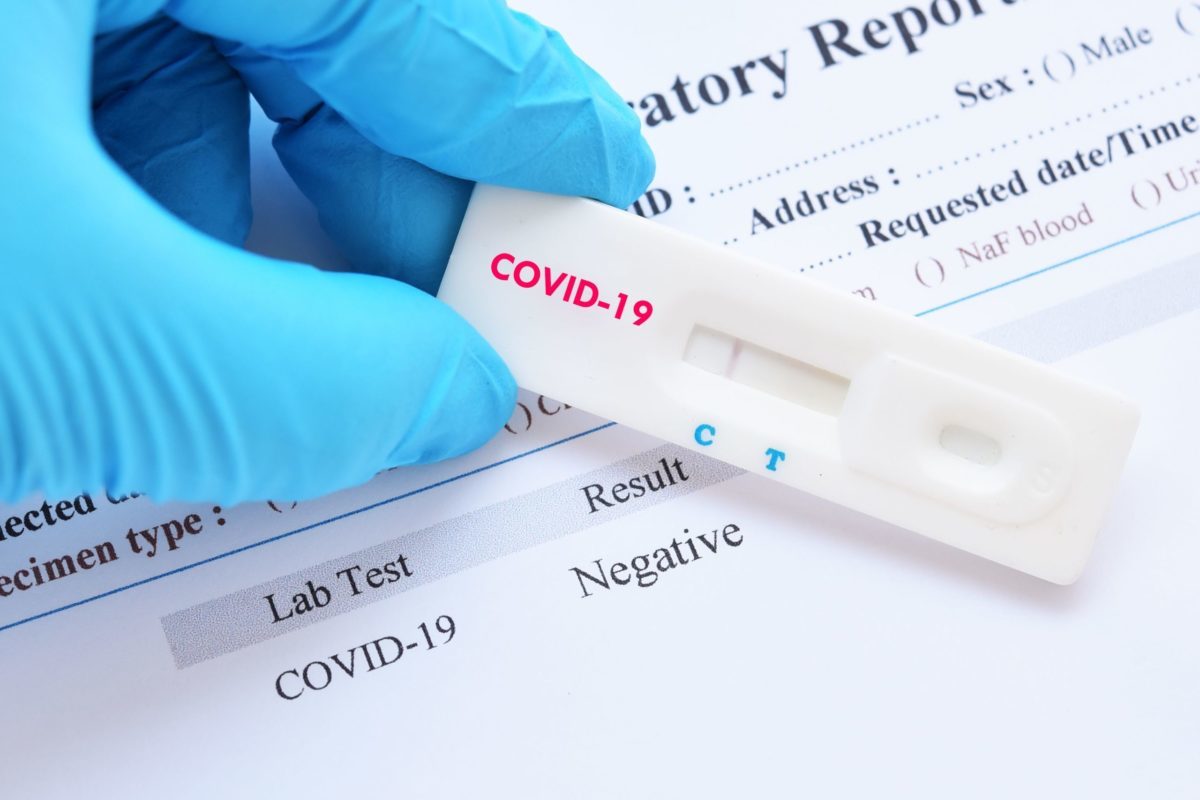 COVID-19 antigén gyorsteszt hétvégén, Koronavírus gyorsteszt, Koronavírus gyorsteszt magánban, COVID gyorsteszt Budapesten, COVID gyorsteszt